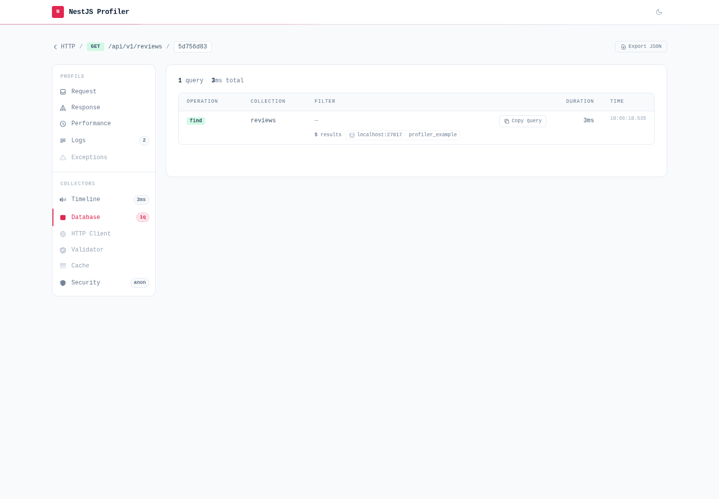 MongoDB panel — Mongoose queries and aggregations with operation badge, collection, duration and result count